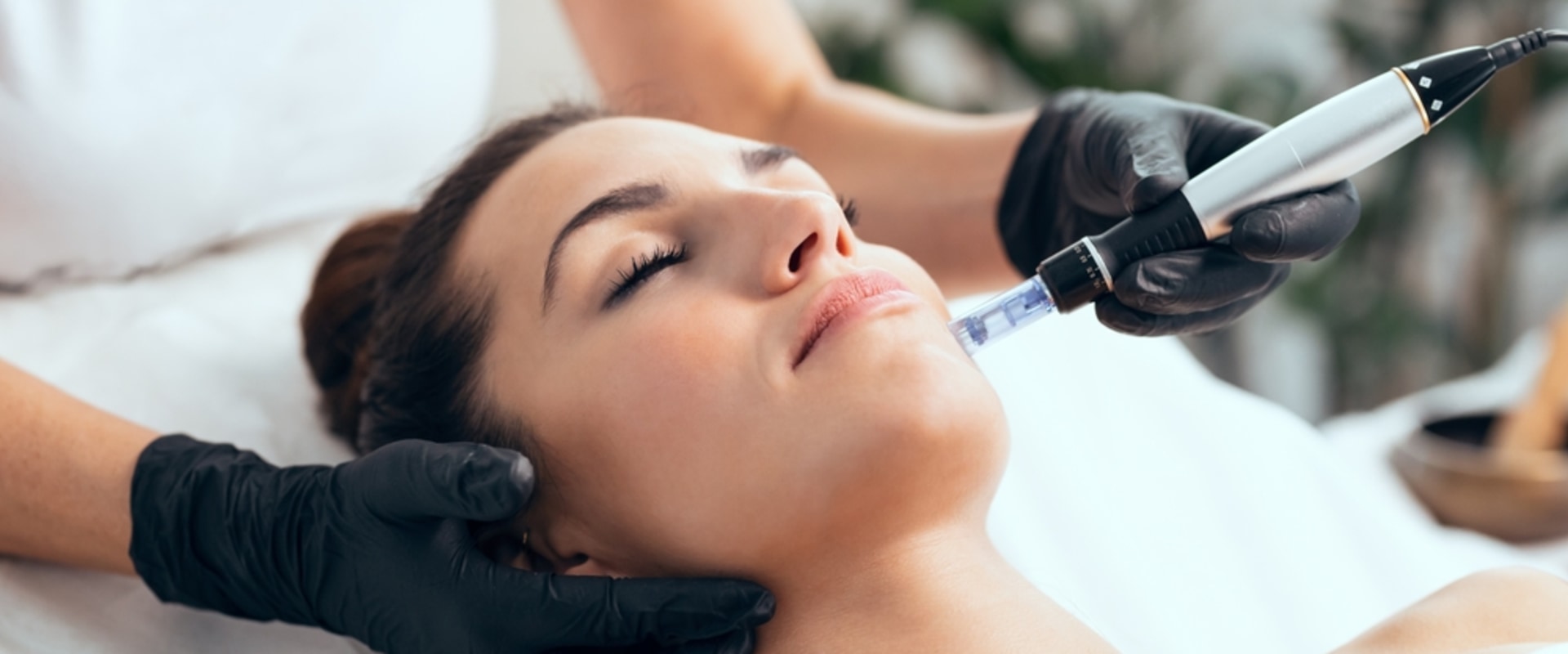 Microneedling In Westlake Village, CA: How Clinical Nutrition Boosts Skin Healing And Rejuvenation