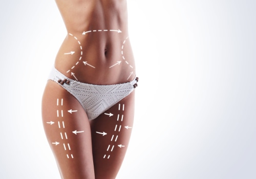 A Combined Approach: Clinical Nutrition And Liposuction For Lasting Results In Scottsdale